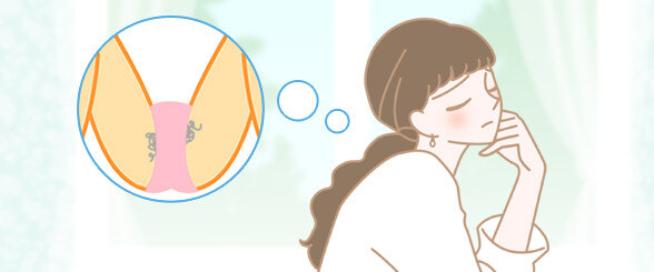 アンダーヘアのお悩み
