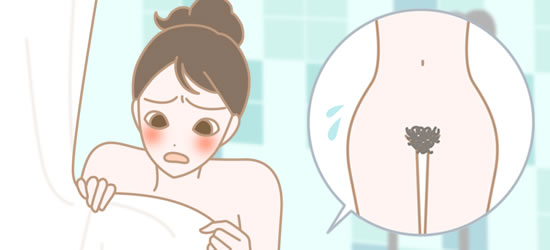 チェック