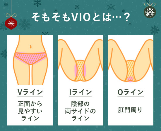 そもそもVIOとは