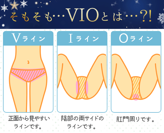 そもそもVIOとは…?