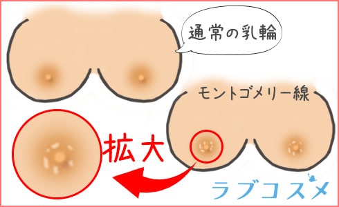 乳輪のぶつぶつ(モントゴメリー腺)って何?