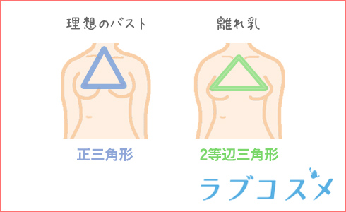 理想のバストと離れ乳のイラスト