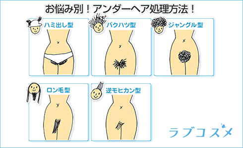 悩み別アンダーヘア処理方法と正しいお手入れ方法