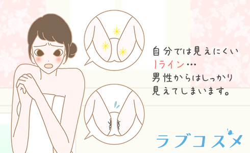 Iアインのアンダーヘアでお悩みの方は…