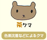 茶色っぽく黄色がかかっている、目の茶クマ。原因はシミやくすみ、色素沈着など。