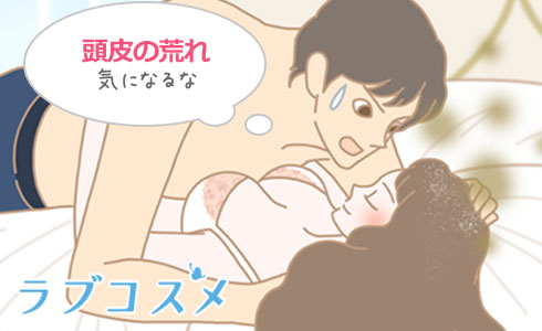 頭皮が乾燥する原因とフケやかゆみを予防するケア方法