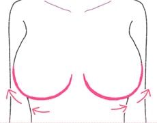 バージスラインをなでるように
