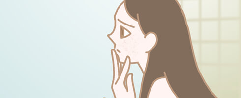 大人ニキビとは?思春期ニキビとの違う大人ニキビの特徴