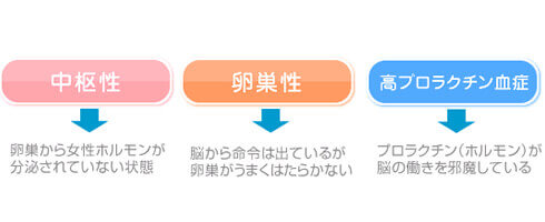 無月経の種類とタイプを説明している画像