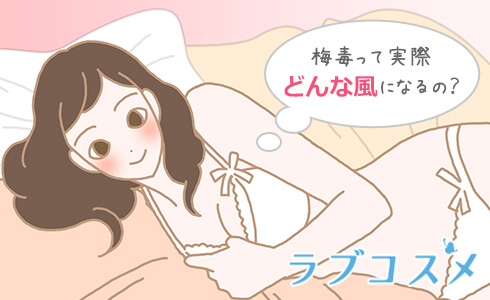 梅毒ってどんな症状?
