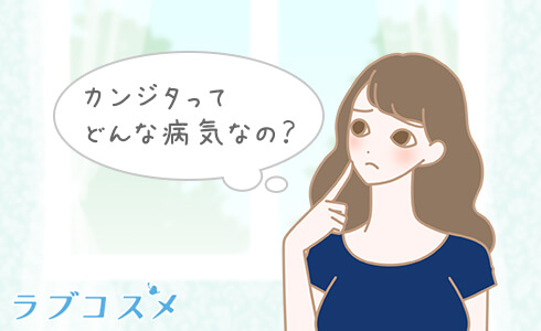 膣カンジタの症状について考える女性のイラスト