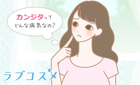 膣カンジタの症状について考える女性のイラスト
