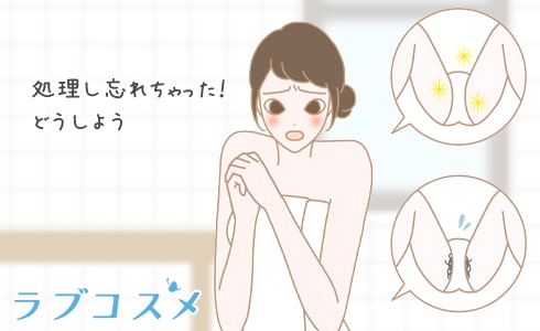 アンダーヘアイラスト
