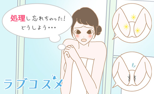 アンダーヘアイラスト