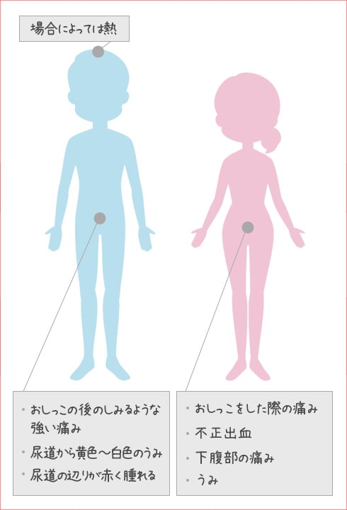 淋病の症状が現れる場所