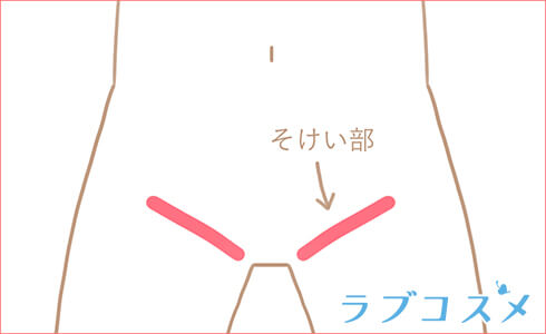 そけい部