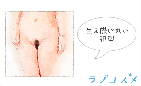 卵型のアンダーヘア