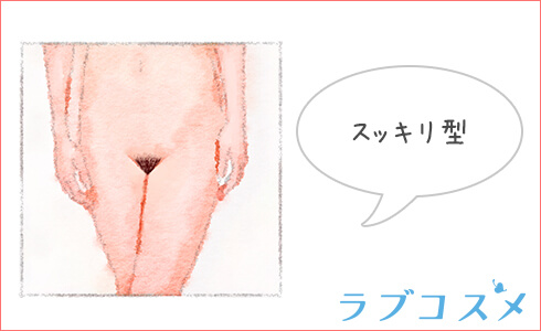 すっきり型のアンダーヘア