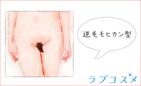 逆毛モヒカン型のアンダーヘア