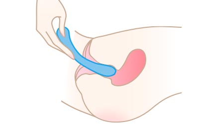 スカイフィット